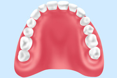 レジン義歯（保険）